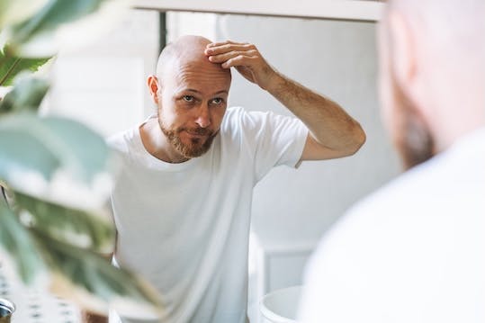 What causes hair loss?